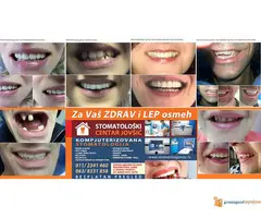 Stomatoloski centar Jovsic - 4